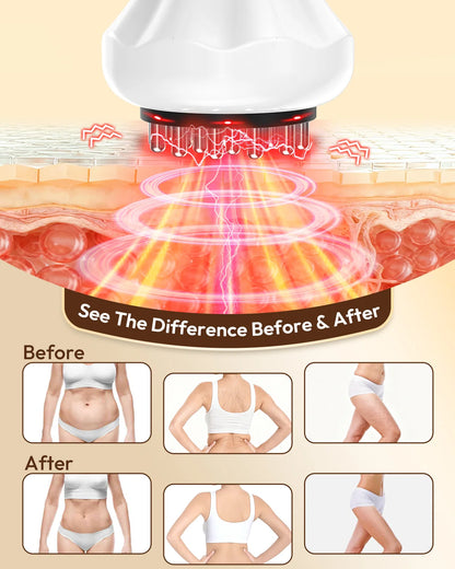 Lymphatic Drainage Massager & Anti-Cellulite Tool